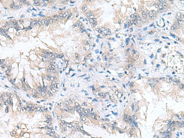 CAMSAP3 Polyclonal Antibody (E-AB-52103)