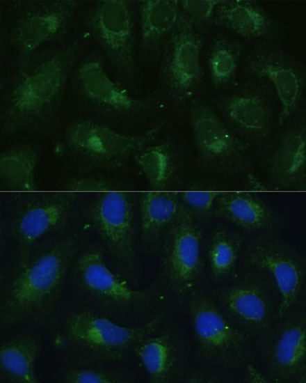 SULT1C4 Polyclonal Antibody (E-AB-65314)
