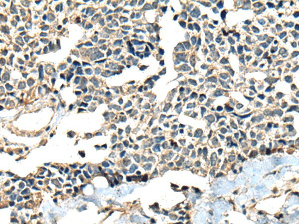 CALHM1 Polyclonal Antibody (E-AB-18583)