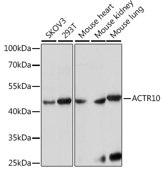 ACTR10 Polyclonal Antibody (E-AB-91324)