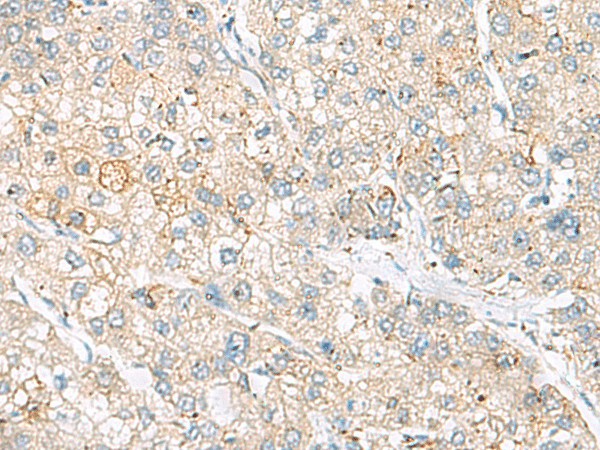 FARP2 Polyclonal Antibody (E-AB-52998)