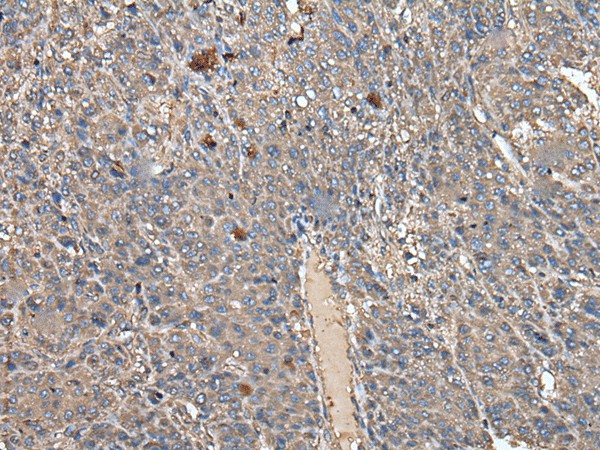 ATAD1 Polyclonal Antibody (E-AB-18523)