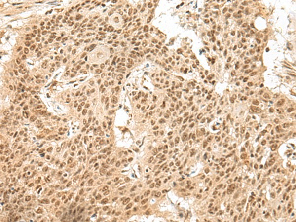 GMEB2 Polyclonal Antibody (E-AB-19918)