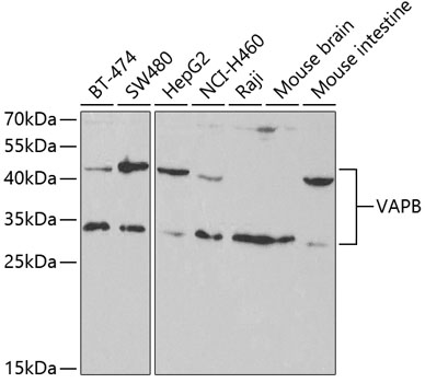 VAPB Polyclonal Antibody (E-AB-60927)