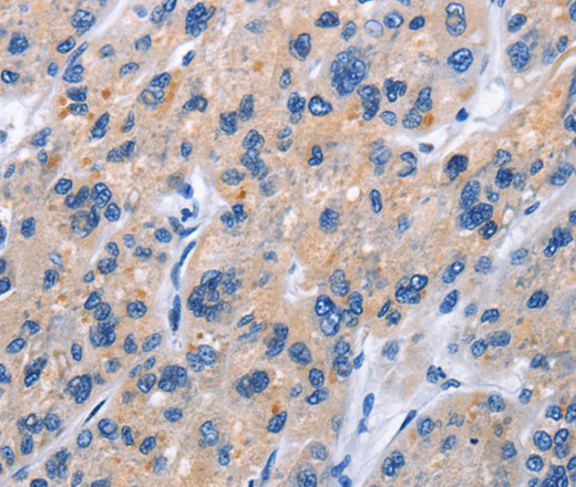 CD137 Polyclonal Antibody (E-AB-14834)