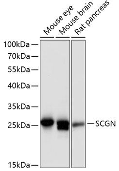 SCGN Polyclonal Antibody (E-AB-64365)