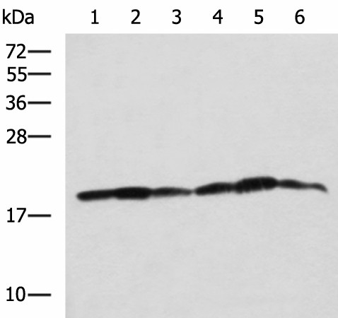 BLOC1S6 Polyclonal Antibody (E-AB-19140)