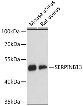 SERPINB13 Polyclonal Antibody (E-AB-64814)