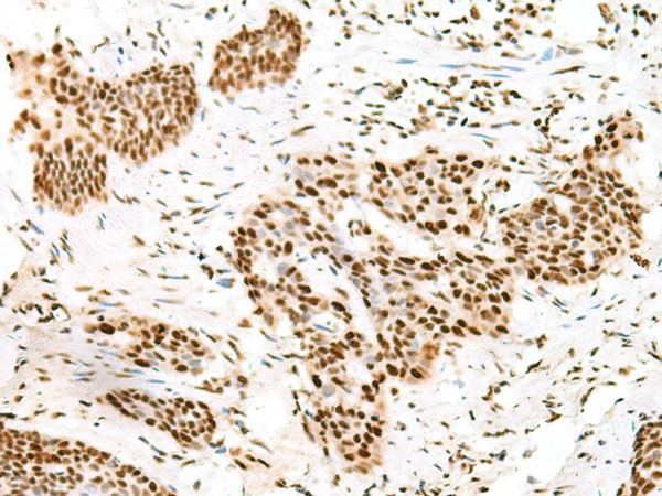 TCOF1 Polyclonal Antibody (E-AB-18871)