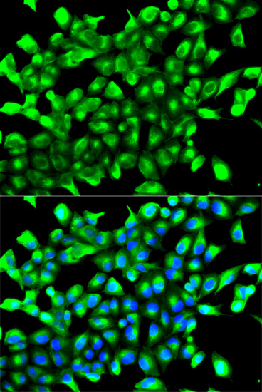EGLN1 Polyclonal Antibody (E-AB-65402)