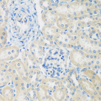 ENPEP Polyclonal Antibody (E-AB-62072)