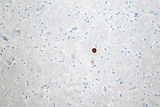 Purified anti-α-Synuclein, 34-45 Antibody (849101)