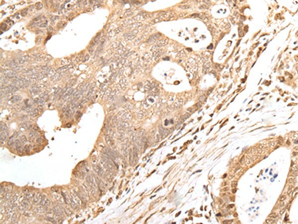 GRAP Polyclonal Antibody (E-AB-18391)