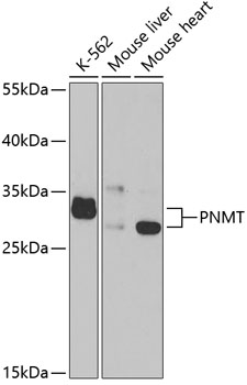 PNMT Polyclonal Antibody (E-AB-61007)