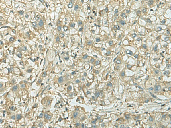 KIF21B Polyclonal Antibody (E-AB-52107)