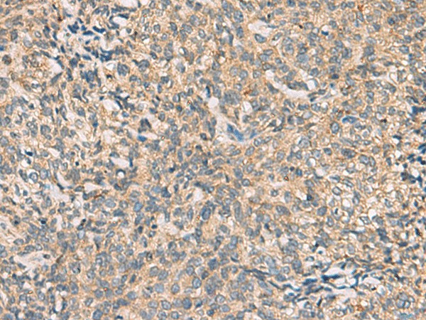 CMTM4 Polyclonal Antibody (E-AB-17832)