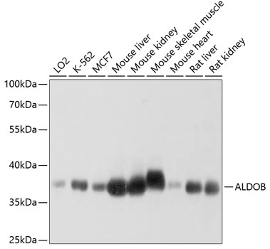 ALDOB Polyclonal Antibody (E-AB-63750)