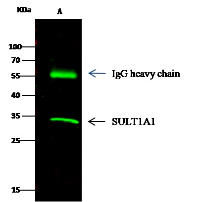 SULT1A1 Monoclonal Antibody (AN200121P)