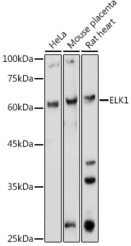 ELK1 Polyclonal Antibody (E-AB-90026)