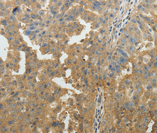 SYT6 Polyclonal Antibody (E-AB-10619)