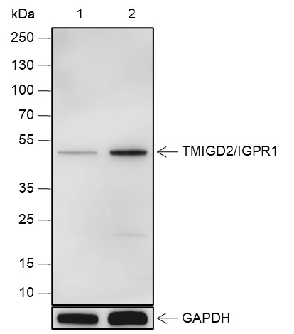 Recombinant TMIGD2/IGPR1 Monoclonal Antibody (AN301839L)