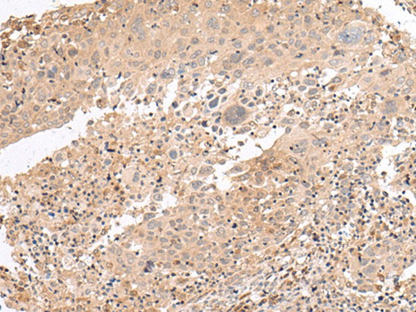 PATJ Polyclonal Antibody (E-AB-17933)