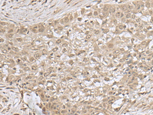 NEUROG3 Polyclonal Antibody (E-AB-52161)