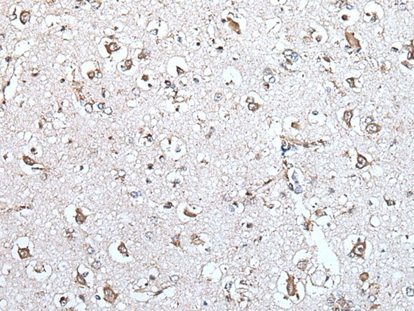 MCM10 Polyclonal Antibody (E-AB-18238)