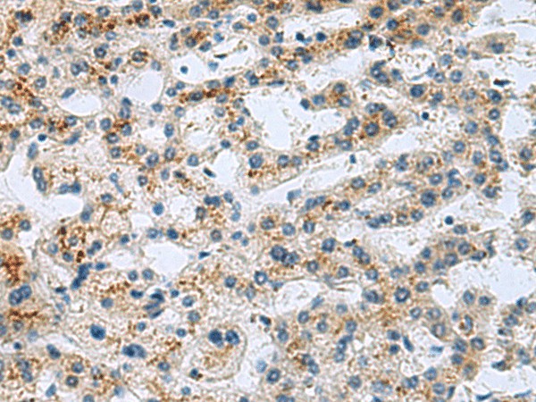 GHRHR Polyclonal Antibody (E-AB-17871)