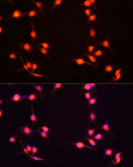 S100B Polyclonal Antibody (E-AB-60087)