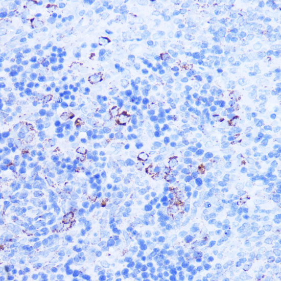 SHMT2 Polyclonal Antibody (E-AB-93343)