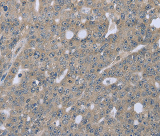 BMX Polyclonal Antibody (E-AB-11201)