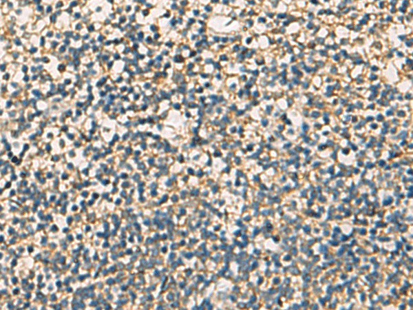 STX6 Polyclonal Antibody (E-AB-19196)