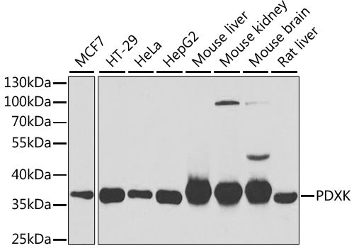 PDXK Polyclonal Antibody (E-AB-61298)