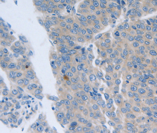 GRIN1 Polyclonal Antibody (E-AB-15806)