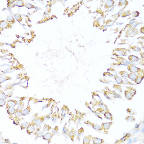 DNAJB11 Polyclonal Antibody (E-AB-64376)