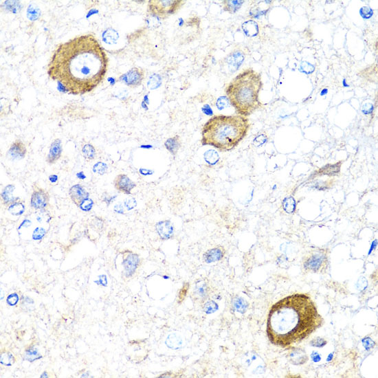 NRG4 Polyclonal Antibody (E-AB-60759)