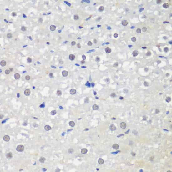 CTCF Polyclonal Antibody (E-AB-64522)