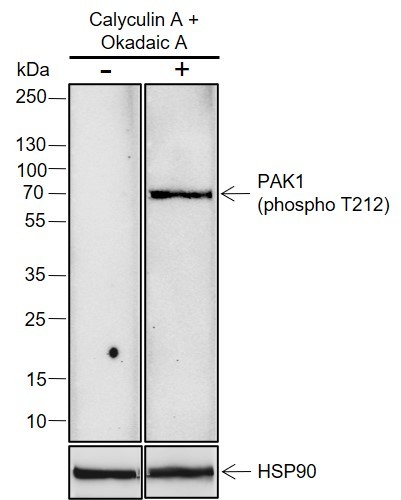 Recombinant Phospho-PAK1 (Thr212) Monoclonal Antibody (AN302100L)