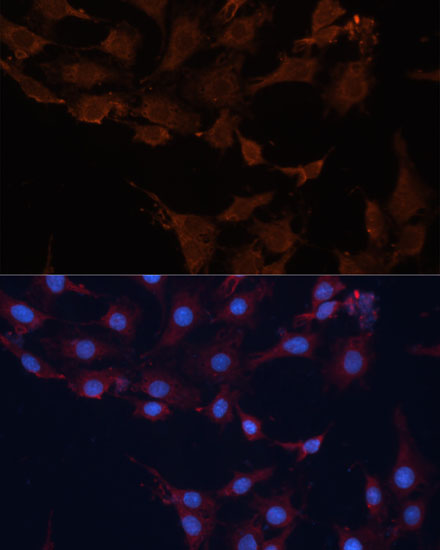 HMGCS1 Polyclonal Antibody (E-AB-63763)