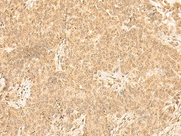 ST8SIA4 Polyclonal Antibody (E-AB-52824)