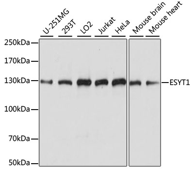 ESYT1 Polyclonal Antibody (E-AB-65305)
