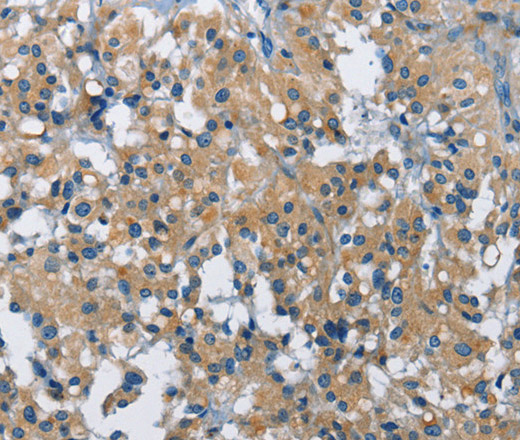 BMPR1B Polyclonal Antibody (E-AB-10187)