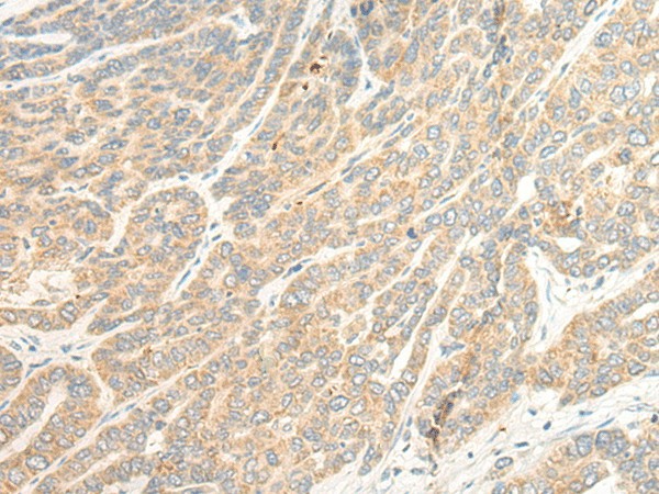 TTC4 Polyclonal Antibody (E-AB-18699)