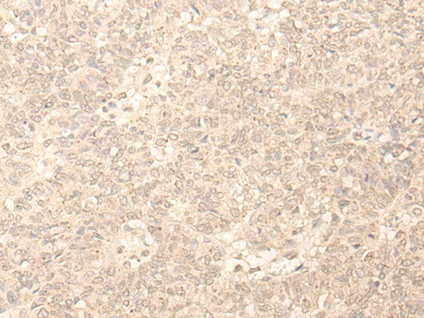 PLEKHA1 Polyclonal Antibody (E-AB-52629)
