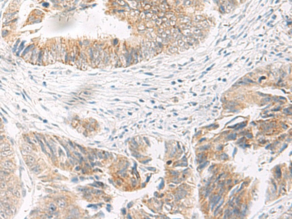IDUA Polyclonal Antibody (E-AB-18101)