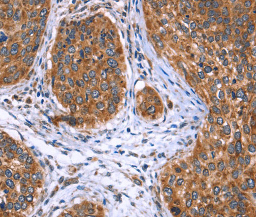 EVC2 Polyclonal Antibody (E-AB-13227)