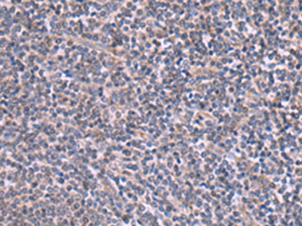 RIC3 Polyclonal Antibody (E-AB-52913)