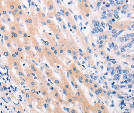 MUC2 Polyclonal Antibody (E-AB-12787)