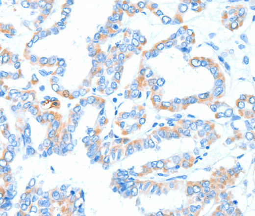 GPT Polyclonal Antibody (E-AB-16144)